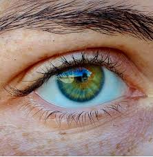 Yes, central heterochromia is rare. Central Heterochromia And Iris Nevi Heterochromia