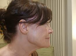 beauty treatment Archives