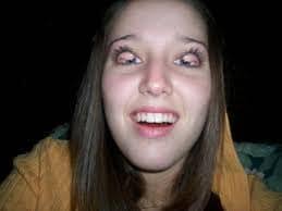 Who used to flip their eyelids inside out as a kid?