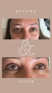 Here’s why a lash lift is a GAME CHANGER 🔥 it’s perfect for busy women and  who want to look put together without make up. Hello get up and go mornings  😍 , Lasts up to 6 weeks so that’s 6 weeks of low ...