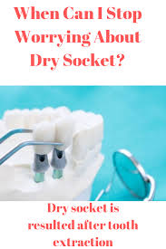 When Can I Stop Worrying About Dry Socket Dry Socket Juicing For Health Health And Beauty Tips
