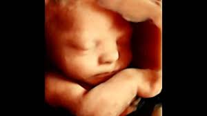 Sofort kostenlos und ohne anmeldung anfragen 3d 4d Ultrasound By 4d Special Delivery Ultrasound Packages Upland Ca