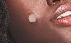 Deep, inflamed pimples how it works: The Best Way To Pop A Pimple