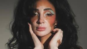 Chhattisgarh: Suzain Khan Crowned Mrs Universe 2025 In Thailand, Bringing  Global Recognition To India