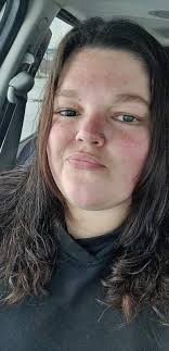 A woman wit no eye lashes no makeup But with natural beauty Bless us with a  pic...