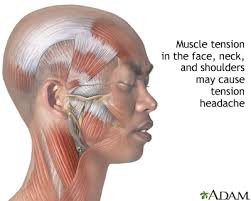 What organs are located in the belly? Tension Headache Medlineplus Medical Encyclopedia