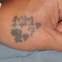 Check spelling or type a new query. 143 Tattoo Removal Doctors Clinics In San Diego Ca Realself