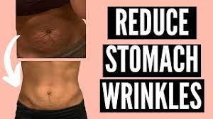 Diet breakthrough that supports weight loss in overweight adults. How To Get Rid Of Stomach Wrinkles Postpartum Naturally Not Dermarolling Tighten Loose Skin Youtube