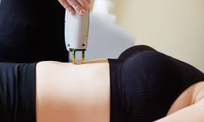 What laser power parameters do you need to follow for hair removal? Naperville Laser Hair Removal Deals In And Near Naperville Il Groupon