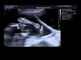 How To Find Baby Boy Or Girl In Scan Report In Tamil Ovulation Signs