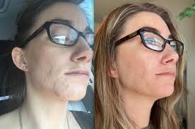 What makes you feel confident about aging with healthy skin?