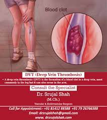 Pin On Be Good To Your Veins