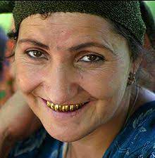 The drawback for a lot of people is that gold is sometimes considered unaesthetic. Gold Teeth Wikipedia