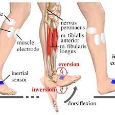 Eversion of the foot is particularly important when walking or running on rough surfaces. Drop Foot Treatment By Functional Electrical Stimulation Of The Nerve Download Scientific Diagram