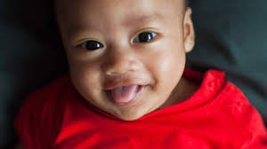Hidden Tongue-Ties' in Infants Have Scant Scientific Backing