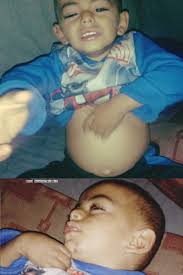 Urgent medical help needed for a child