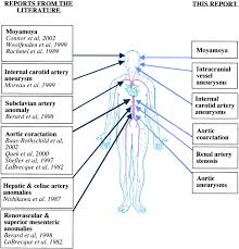 Vascular Anomalies In Alagille Syndrome Circulation