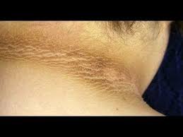 Pin On Health