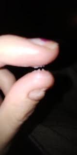 What kind of cervical mucus should i expect after ovulation if i am pregnant? Help Tmi Lot Of White Wet Cm After Ovulation Babycenter