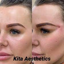 Search for local clinics near you on yell. Kita Aesthetics Photos Facebook