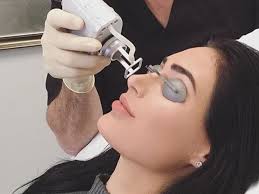 There are numerous alternatives to eye surgery for glaucoma that you may want to try out first—especially considering the sometimes prohibitive eye surgery costs. Everything You Need To Know About Non Surgical Cosmetic Procedures Fashionista
