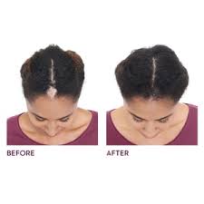 Hundreds of women are discovering a brand new way to make their hair look thicker and voluminous. Keranique Hair Regrowth Treatment For Women 2 Oz Cvs Pharmacy