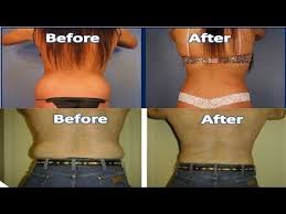 Pin On Exercises
