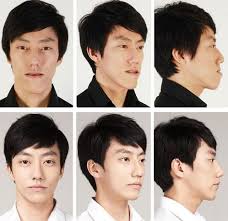 31 Crazy Before And After Photos Of Korean Plastic Surgery Korean Plastic Surgery South Korean Plastic Surgery Plastic Surgery Pictures