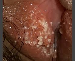 A Noninvasive Aid For Office-Based Gynecologists For The Diagnosis Of  Common External Genital Disorders - Document - Gale Academic Onefile