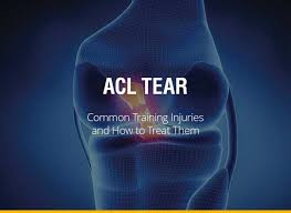 The most common injury is a complete tear. Common Training Injuries And How To Treat Them Acl Tear Fight Quality