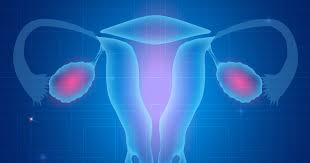 Symptoms become more noticeable as the cancer progresses. Study Fallopian Tube Lesions An Early Sign Of Ovarian Cancer Ctca