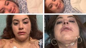 Fundraiser for Kristina Balderrama by Ally Hernandez : Help Kristina from a  Thanksgiving Tragedy