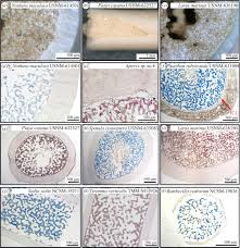 Birds have bone marrow it just doesn't intersperse through the central region of bones like in humans. Identifying Medullary Bone In Extinct Avemetatarsalians Challenges Implications And Perspectives Philosophical Transactions Of The Royal Society B Biological Sciences