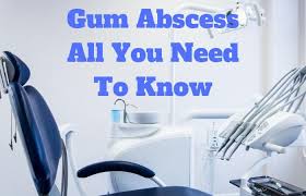 Below are some of the tips to drain a gum abscess at home. Pin On I Love Alternative Medical Health Careers