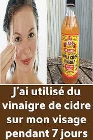 J Ai Utilise Du Vinaigre De Cidre Sur Mon Visage Pendant 7 Jours Natural Face Moisturizer Beauty Tips For Face Vinegar With The Mother
