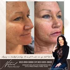 Amanda Jackson Liles (@naturalaestheticsbyamanda) · Instagram 照片和视频