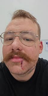 I was 16 here this was 2 years ago and 2 months after this video I  shattered my leg in a wreck smh