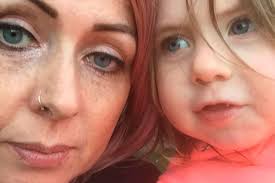 Meet the Northern Ireland people battling eczema who are finally  comfortable in their own skin