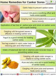 Alternative medicine offers effective natural treatments for these painful and annoying shallow lesions that to be able to treat a canker sore, you need to know how to determine whether it is a canker sore or a cold sore. Home Remedies For Canker Sore Home Remedies For Canker Sore Include Intake Of Garlic Harir Buttermilk Fenug Canker Sore Home Remedy For Canker Sores Cankers