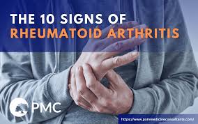 Image result for Rheumatoid Factor