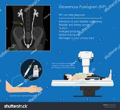 Image result for Intravenous Pyelogram