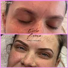 Evolve Brows & Aesthetics Dronfield