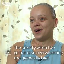 Acid attack victim supports review of sentencing