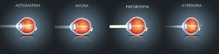 Image result for Presbyopia