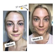 Collagen Boost Infused With Vitamin C