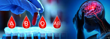 Blood group could trigger an early stroke