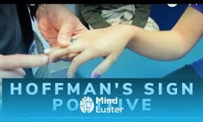 Image result for Hoffman Sign