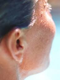 Vi gjorde det jaggu igjen!!! Ny Viten Om Oresus Tinnitus Australske Fors Nervesystemet