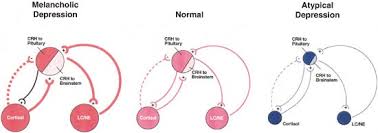 Image result for Atypical Depression