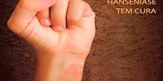 Resultado de imagem para mes roxo janeiro